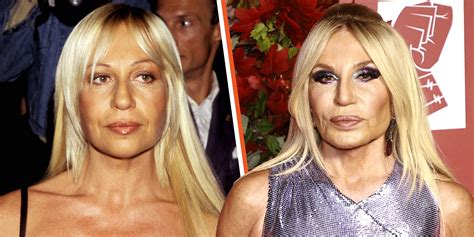 versace visage|current pictures of donatella Versace.